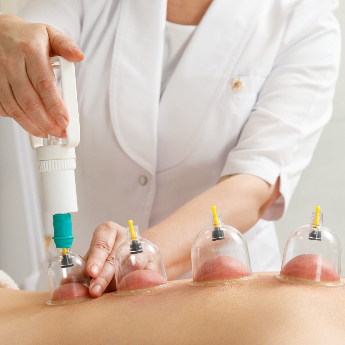 Vacuum Cupping Set 6 Pcs Kit Pull Out a Vacuum Apparatus Therapy Relax Massagers Curve Suction Pumps - Image 3