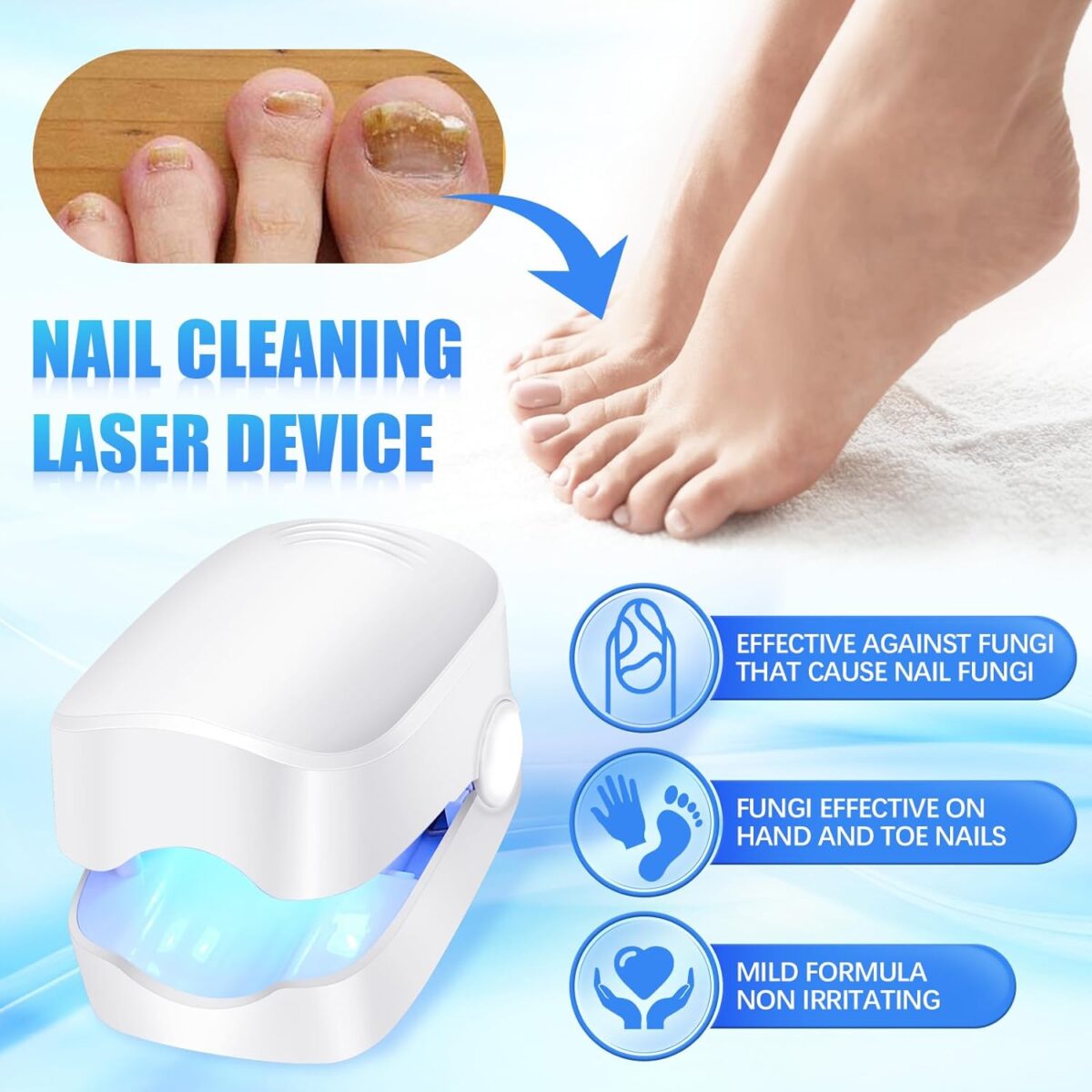 Rechargeable Nail Fungus Laser â€“ Anti-Fungal Device for Toenails, Hands & Feet (Home Use) - Image 3