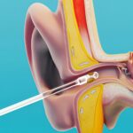 Ear wax Cleaner Stick Silicone Reusable Sticky Ear wax Removal Kit (12 Pcs Set) - Image 3