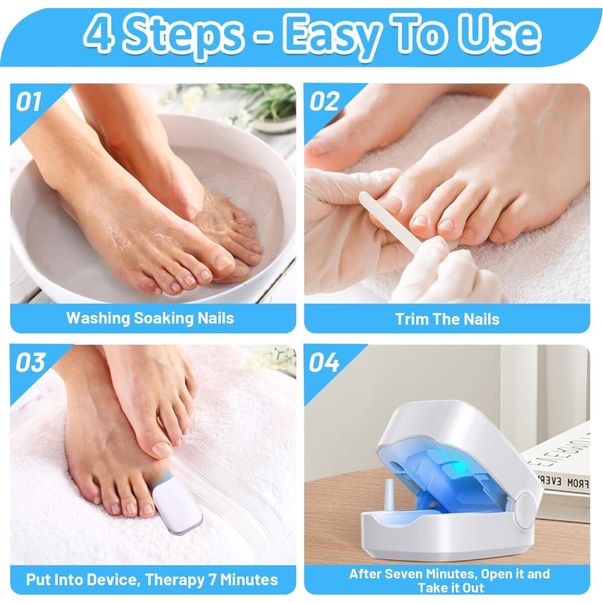 Rechargeable Nail Fungus Laser â€“ Anti-Fungal Device for Toenails, Hands & Feet (Home Use) - Image 6