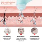 Mini Handheld Vacuum Blackhead Remover â€“ Facial Massage & Spot Lifting (1 Pc) - Image 5