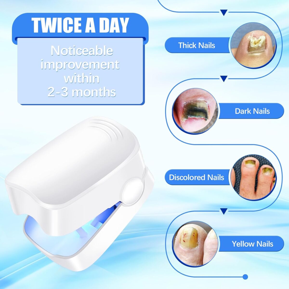 Rechargeable Nail Fungus Laser â€“ Anti-Fungal Device for Toenails, Hands & Feet (Home Use) - Image 7