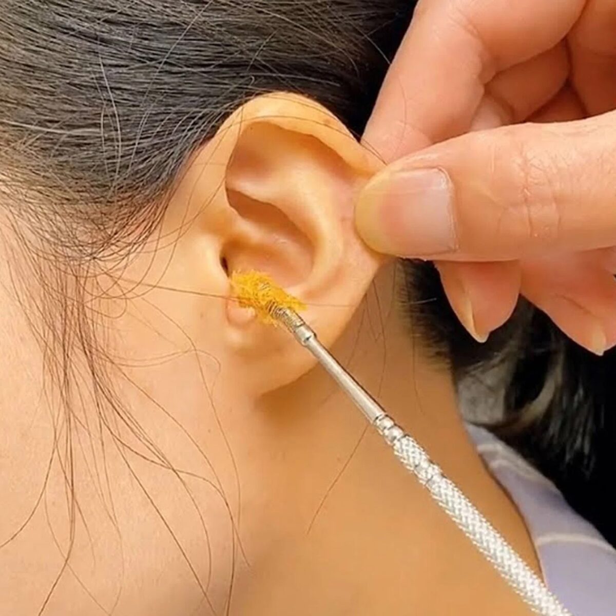 Ear Wax Removal Kit Ã¢â‚¬â€œ Portable Ear Cleaning Tool with Keychain Holder (6 Pc) - Image 5