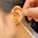 Ear Wax Removal Kit â€“ Portable Ear Cleaning Tool with Keychain Holder (6 Pc) - Image 5