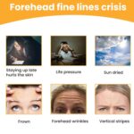 Forehead Wrinkle Patches, Face Wrinkle Patches (10 Pcs Set) - Image 4