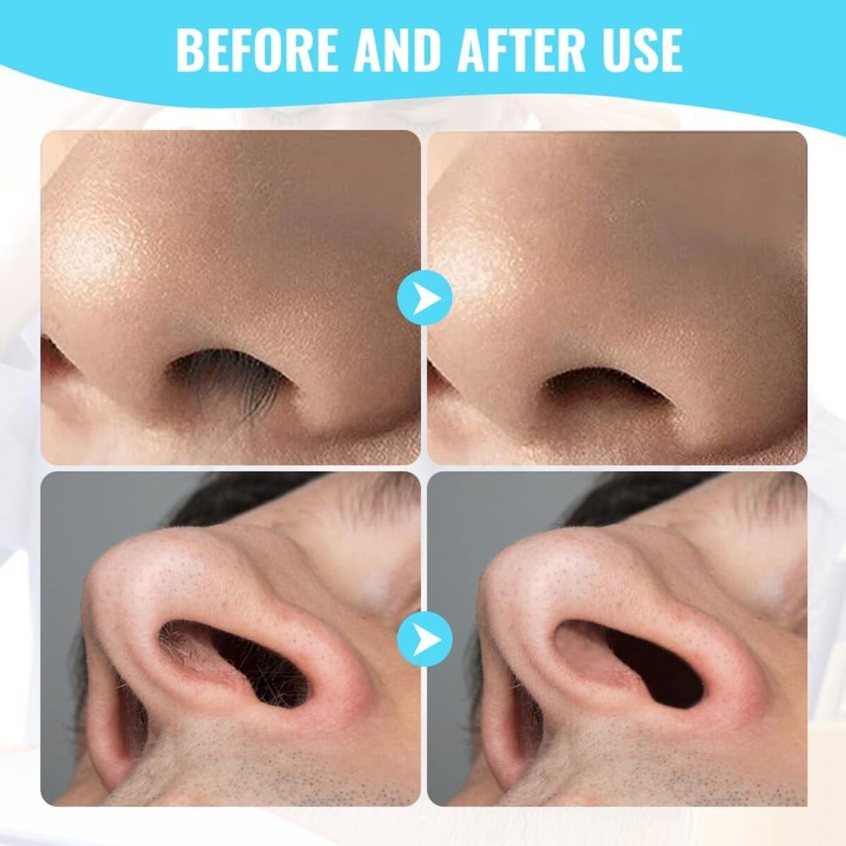 Nose Hair Removal Trimmer Nose Hair Remover Razor Kit Blade (3 Pcs Set) - Image 7